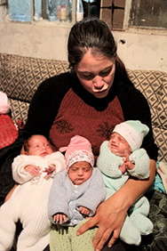 Nacimiento de trillizas en el Hospital de Rivera